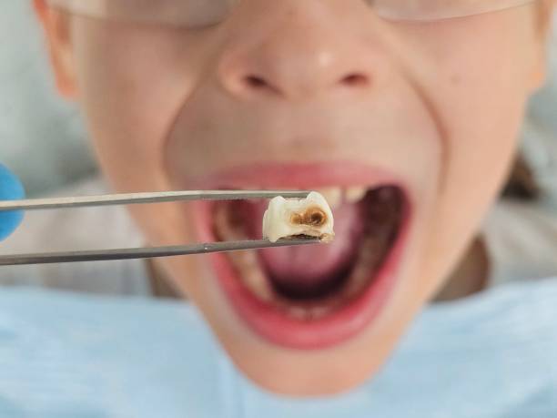 Best Emergency Gum Pain Relief  in Baldwin, MI